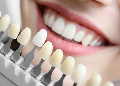 teeth whitening in doncaster 