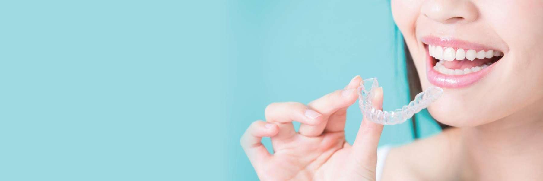 Invisalign clear braces in doncaster 