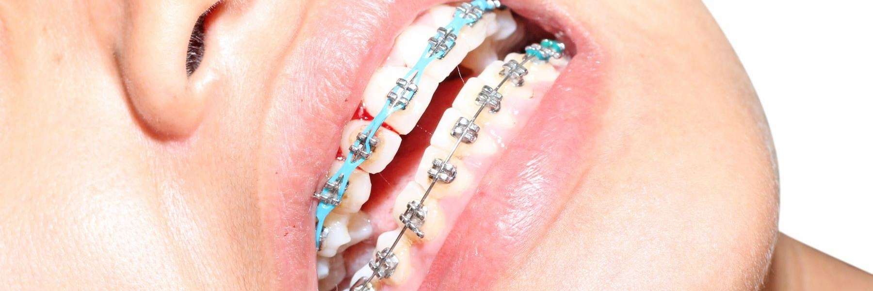 orthodontist in doncaster