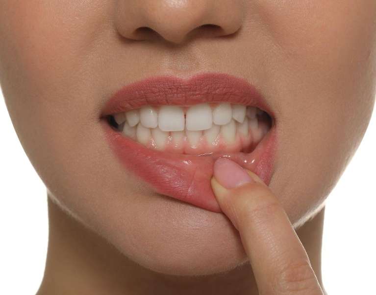 girl with bleeding gums in doncaster