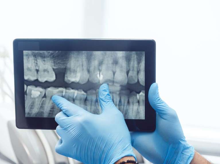 digital x-rays in doncaster vic