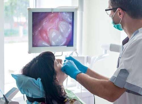Intraoral Cameras in doncaster vic